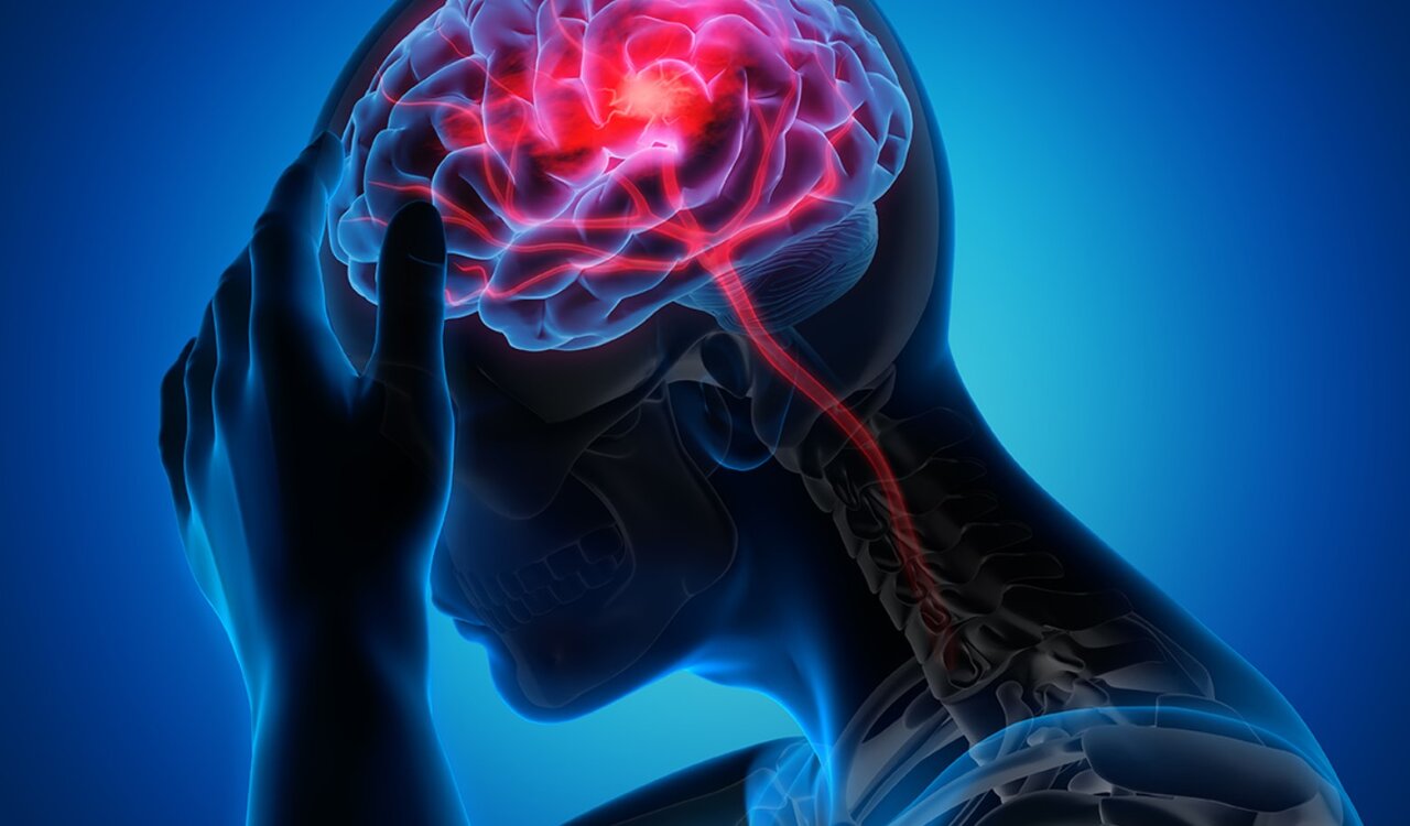     اگر خستگی دائمی دارید ، ممکن است سکته مغزی خفیف داشته باشید!